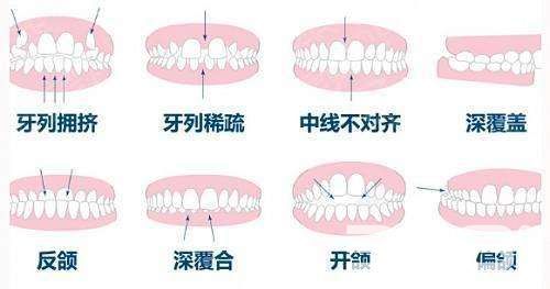 牙齿问题