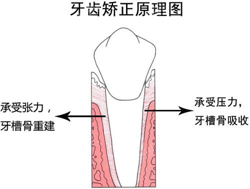 牙齿正畸可以改善脸型