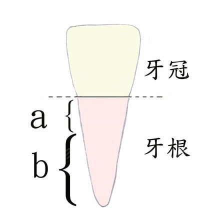 牙根浅