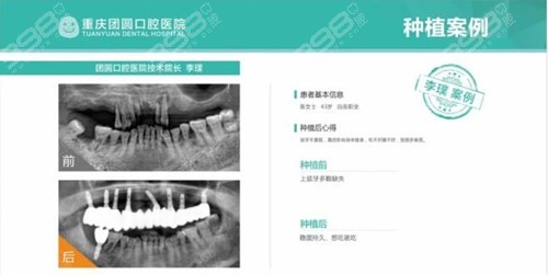 重庆团圆口腔医院到底好不好