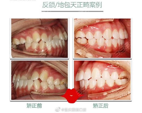 重庆团圆口腔医院到底好不好