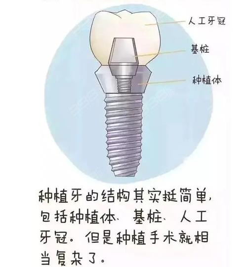 南昌种植牙医生推荐