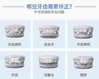 需要矫正的牙齿类型