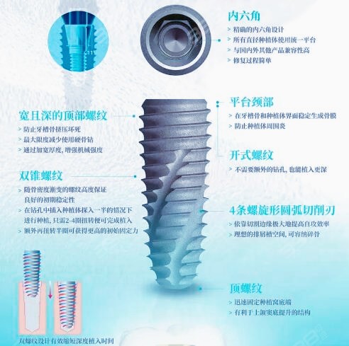 韩国伊诺种植牙质量怎么样