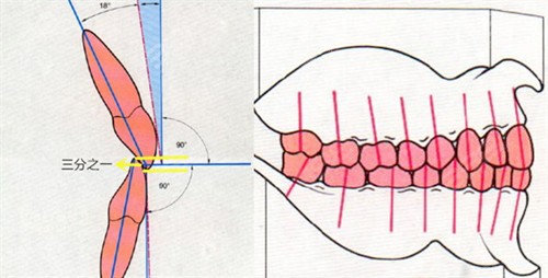 单咬口示意图图片