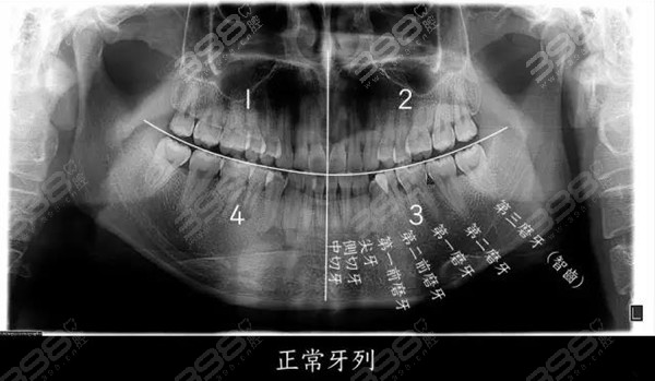 智齿是长在哪个位置的？