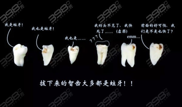 智齿是长在哪个位置的?多图演示智齿生长的位置和样子