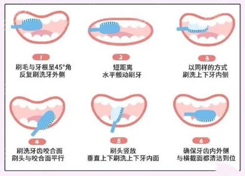 巴氏刷牙