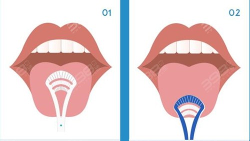 刷牙刷舌苔好还是不好？
