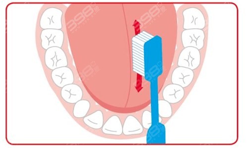 刷牙到底要不要刷舌头