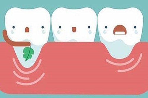 这几个小习惯 让大家预防牙龈萎缩哦