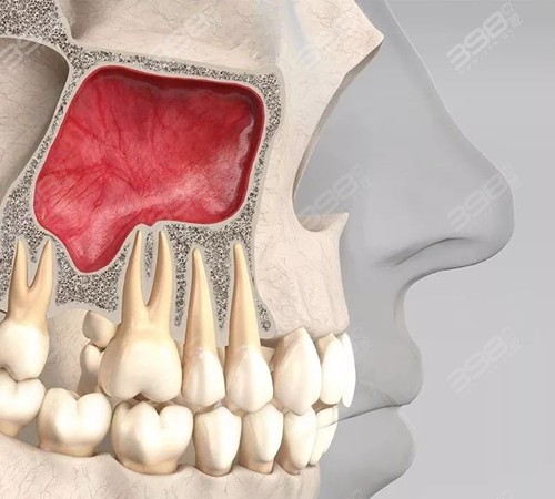 上颌窦图片大全图片图片