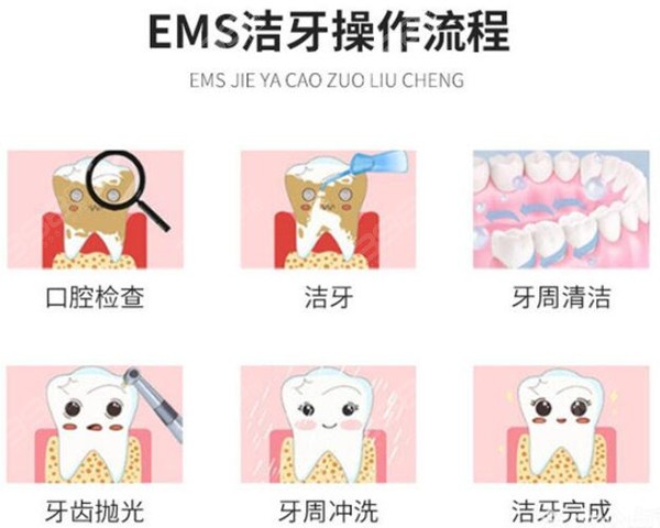 牙博士口腔价格表-洗牙