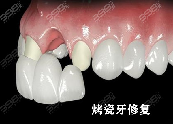 src=http___www.dental-clinic.cn_uploads_allimg_170523_1-1f523163951d7.jpg&refer=http___www.dental-clinic_副本.jpg