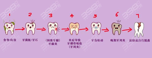 牙周炎情况比较**