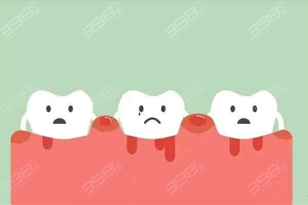 两分钟了解牙龈出血是什么原因及治疗方法 让你远离烦恼