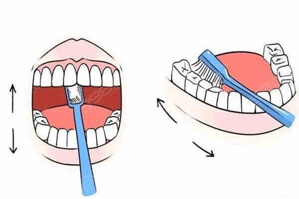 正确刷牙方式