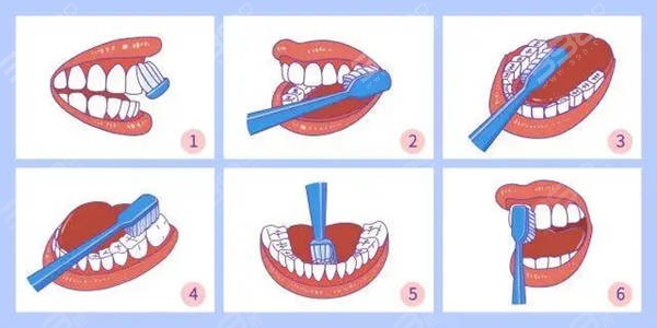 正确刷牙