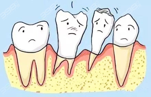 牙周炎导致牙槽骨吸收可以吗