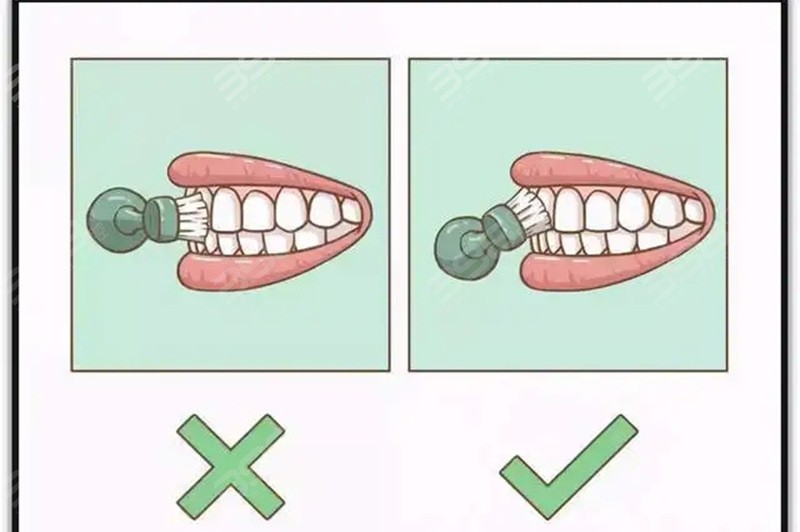 正确的刷牙方式
