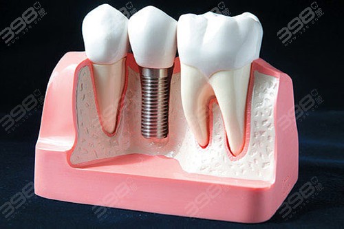 长沙天心区种植牙医院哪家好？跪求天心区种牙性价比高的牙科医院
