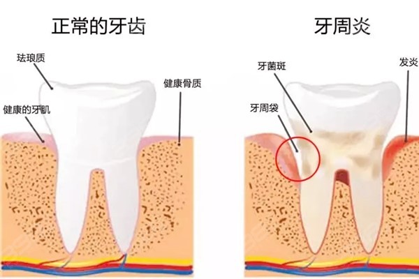 为什么要分享女性口腔健康护理常识