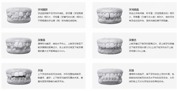 隐秀隐形矫正适应症