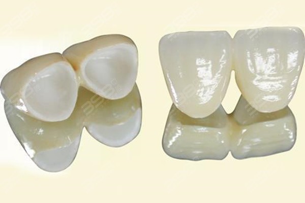 上海做全瓷牙技术好且正规价格便宜又好的牙科排名