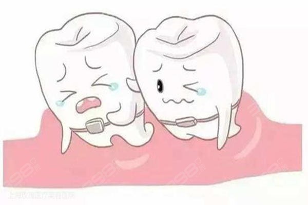 牙周治疗