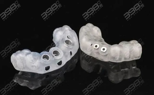 导板种植牙和普通种植牙的区别是什么？