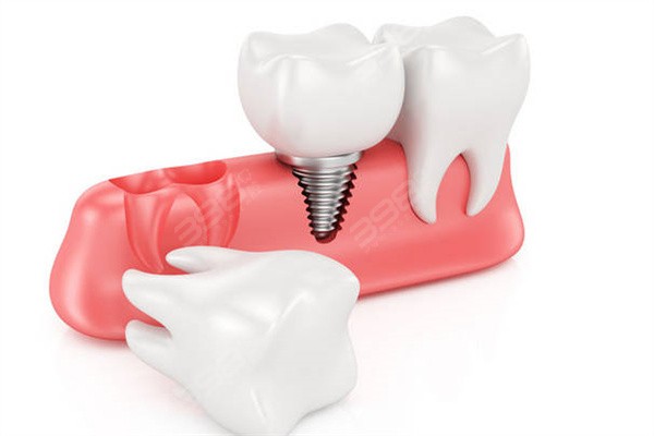 黄石牙科医院收费价目表：种植牙2680起、牙齿矫正6800起、拔智齿300起
