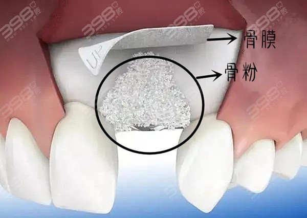 广州黄埔区米檬口腔