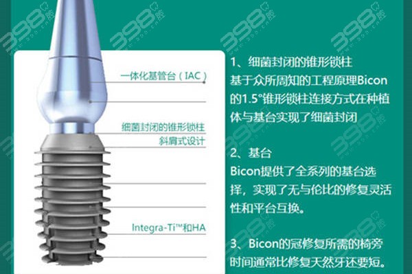 2024国产种植牙费用——980元起