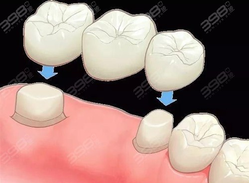 湖南省牙科医院排名榜前十名 涵盖长沙/岳阳/衡阳等地正规牙科名单