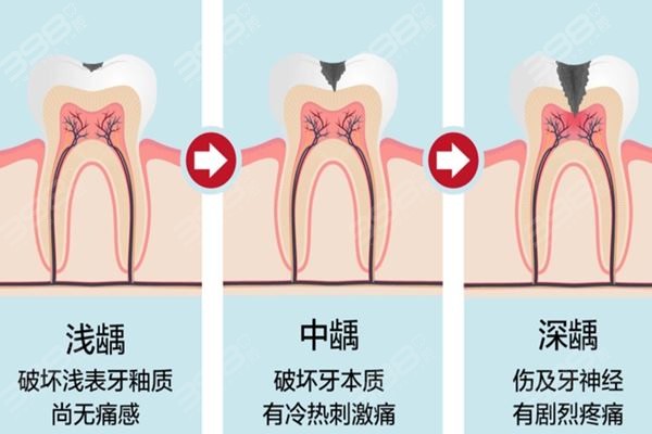 龋病