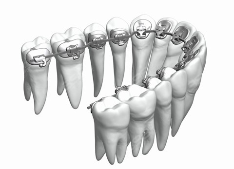 正畸bolton图片