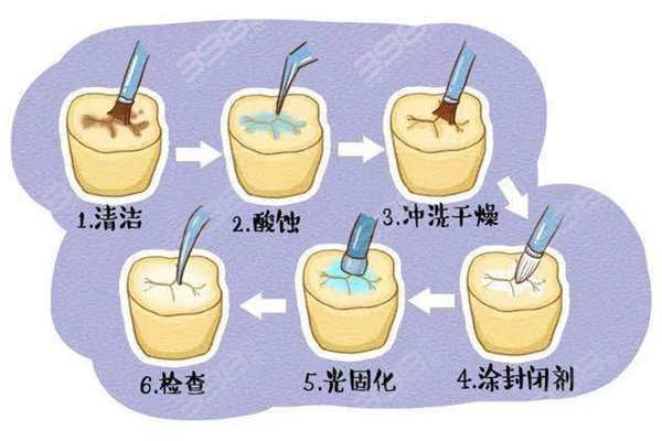 银川补牙多少钱一颗？2025补牙价格表200起附银川补牙经济实惠牙科