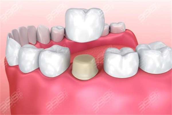 大连口腔医院镶牙价格