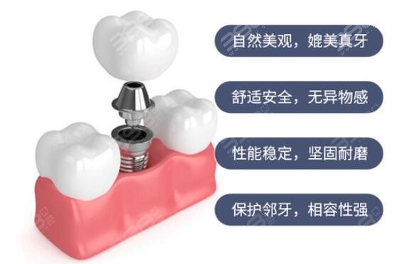 深圳口腔医院种植牙多少钱一颗