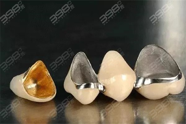 蓝天口腔医院烤瓷牙、全瓷牙、镶假牙多少钱？