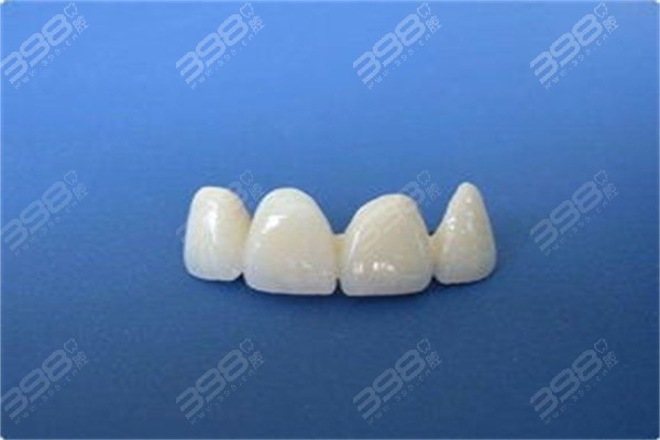 烤瓷牙200元一颗怎么样能用吗？低价烤瓷牙的风险要考虑到