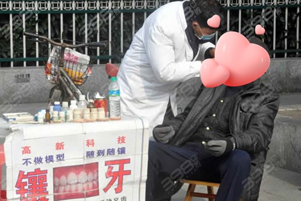 街头镶牙用的是什么？自凝塑料靠谱吗？镶牙能维持多久？