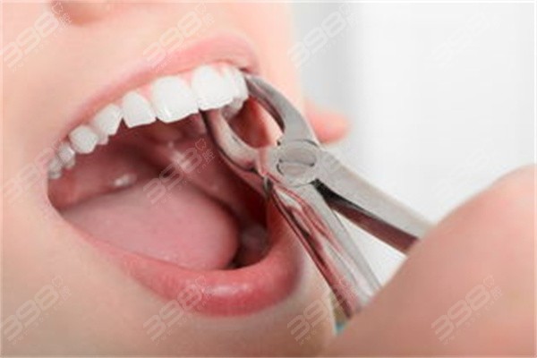 北京劲松口腔拔牙价格