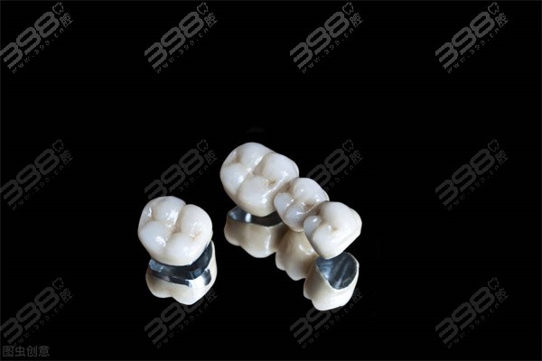 300、500和800元的烤瓷牙有啥区别？烤瓷牙低价背后潜在风险要注意啦