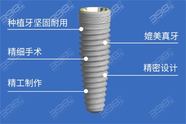 德国ABT种植牙属于什么档次？中高档次材质/工艺/价格都不错