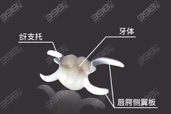 粘接桥牙齿多少钱一颗?种植牙好还是粘接桥牙齿好？客观来分析两者区别