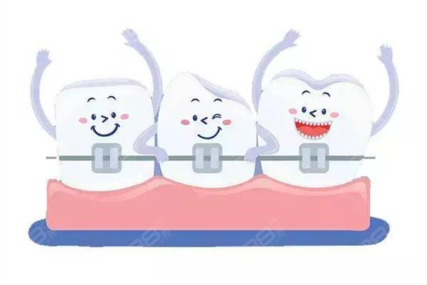 上海正畸比较好的私立牙科有哪些?维乐/城本/马泷/雅悦/美奥矫正牙齿便宜